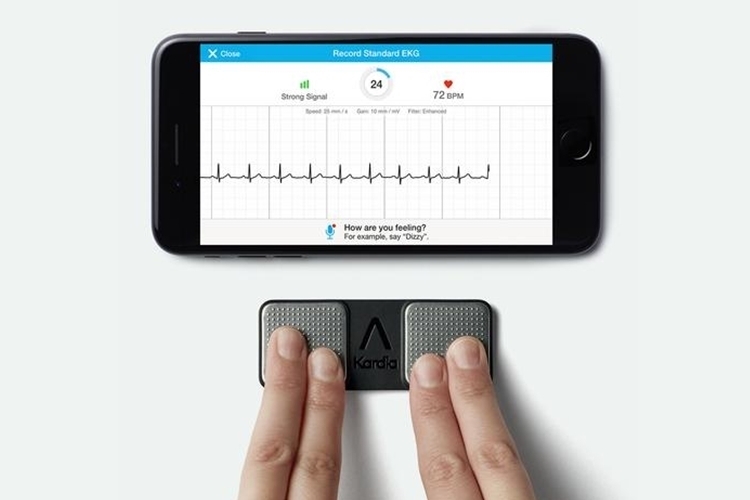 Kardia Mobile EKG